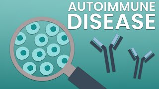 Autoimmune disease research solutions