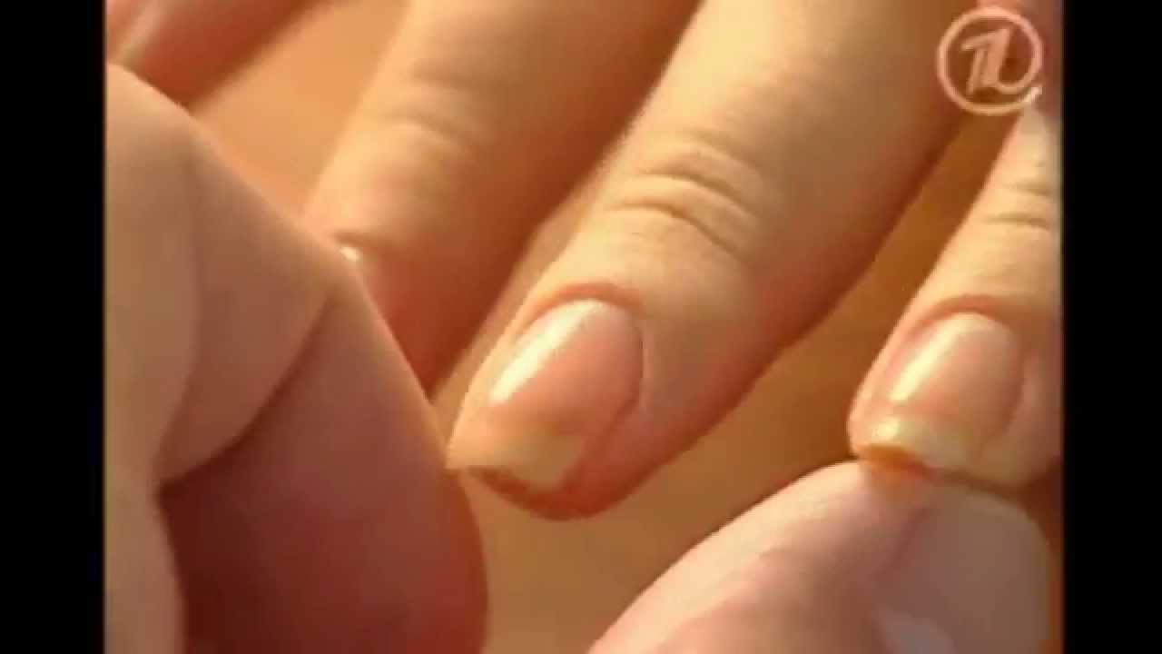 Что означают белые точки на ногтях Что означают белые точки на ногтях