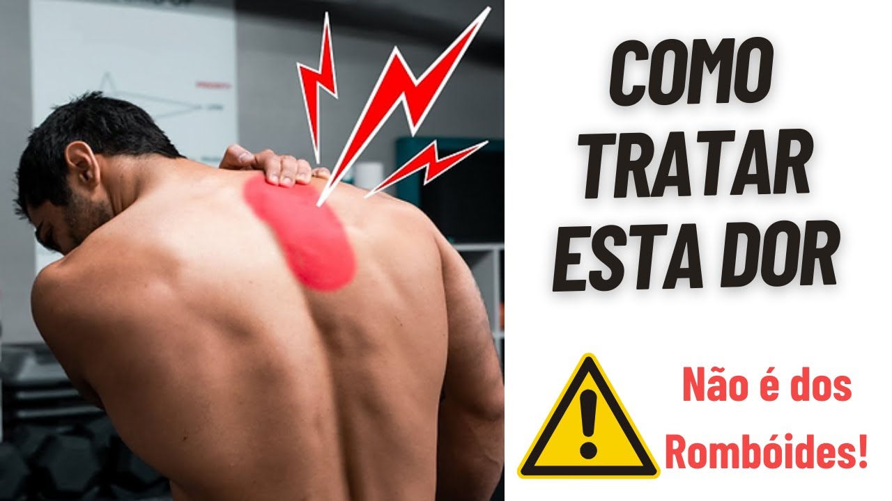 Dor na Escápula | O Verdadeiro Problema e Exercícios para Tratar - YouTube