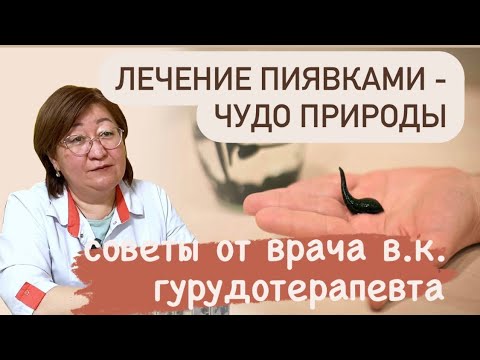 ЛЕЧЕНИЕ ПИЯВКАМИ - ПОЛЕЗНО ЛИ? Осебенности гирудотерапии, советы от апитерапевта Айгул Мелисовной