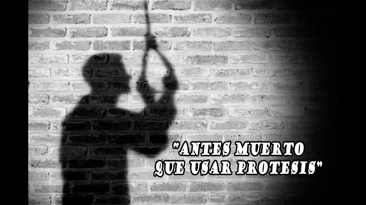 "PREFERIAN QUITARSE LA VIDA QUE VIVIR CON PROTESIS...