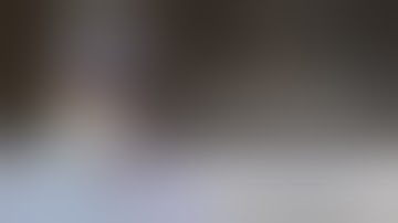 Laparoscopic excision of Duodenal gist