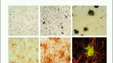 Neuroinflammation Models Use in Studies of Neurodegeneration and Regeneration