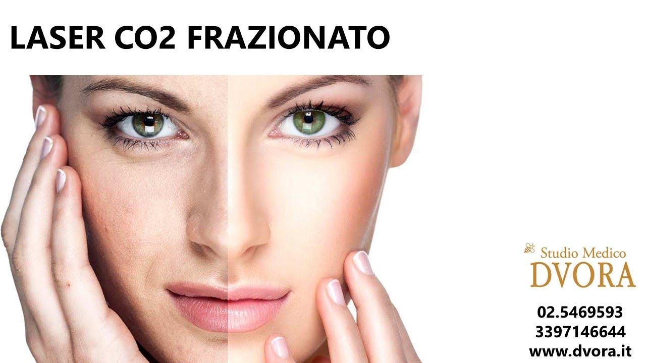 TRATTAMENTO LASER CO2 FRAZIONATO VISO E OCCHI