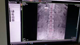 Pacific X-ray Technologies Training Video#3