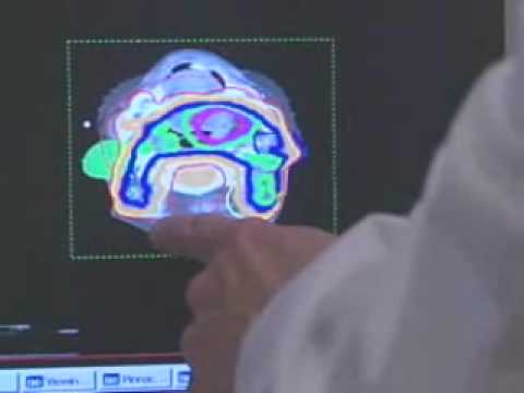 Cancer Care in Wakefield at the Rex Cancer Center - Rex HealthBreak