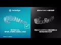 【インビザライン】どのマウスピース矯正を選ぶ?