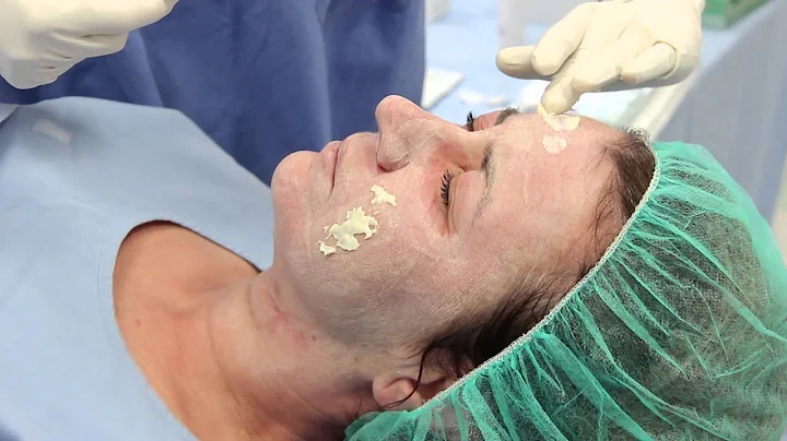 Zo® Skin Health 3 Step Peeling