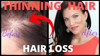 Fix THINNING HAIR & BALD SPOTS *** IN SECONDS *** FEMALE HAIR LOSS - MATURE BEAUTY OVER 40