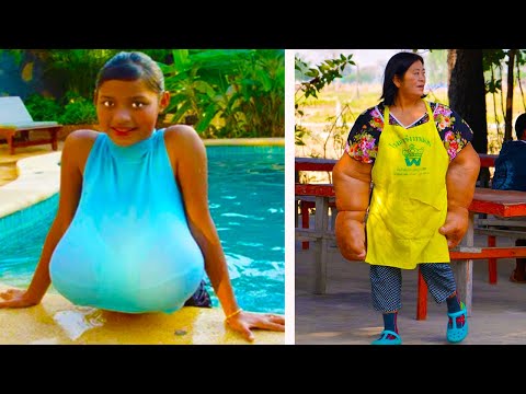 Она Родилась Не Такой Как Все! САМЫЕ БОЛЬШИЕ ЧАСТИ ТЕЛА!