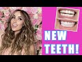 VENEERS Q&amp;A - All the Tea on NewFace MD Dr. Andreina Jativa &amp; Composite Veneers