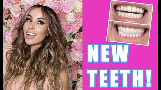 VENEERS Q&amp;A - All the Tea on NewFace MD Dr. Andreina Jativa &amp; Composite Veneers