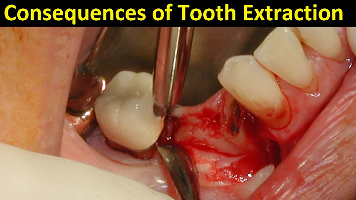 Does Tooth Extraction Cause Narrow Smile, Facial Damage & Tongue Space Reduction by Dr Mike Mew - DayDayNews