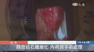 把酒當日常 中年男胰臟發炎 胰管結石
