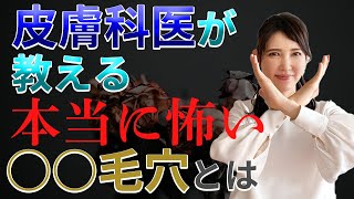皮膚科医が教える本当に怖いすり鉢毛穴とは Youtube
