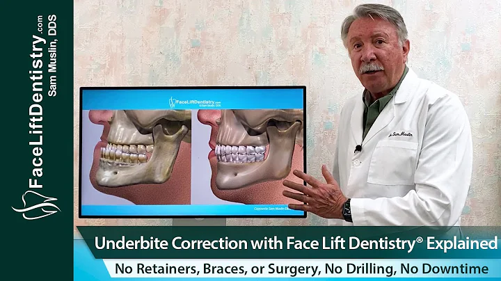 Correzione dell'innesto sotto il mento senza chirurgia - Scopri il metodo innovativo Facelift Dentistry