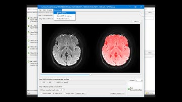 Diffusion MRI processing (TOPTUP/EDDY) and reconstruction using DSI Studio