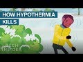 What Hypothermia Does To Your Body And Brain