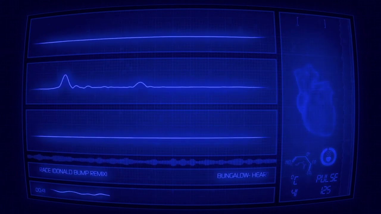 [WR034] Bungalow- Heart Race (Donald Bump Remix)