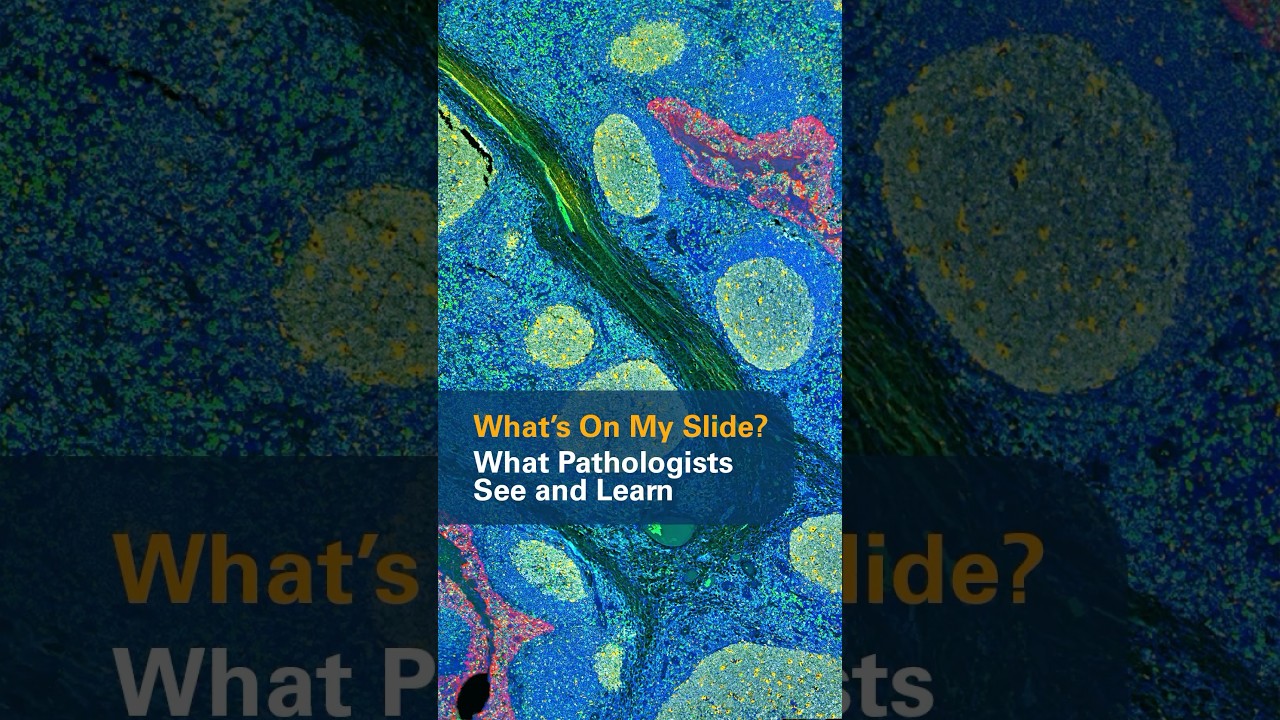 What’s on My Slide? What Pathologists See and Learn