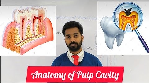 Anatomy of Pulp Cavity - part1