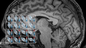 Introduction to Diffusion-Weighted MRI and Microstructure Imaging