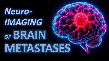 Imaging of cerebral metastases