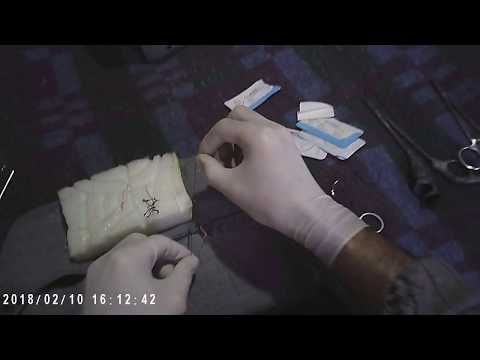 ქირურგიული კვანძები და მარყუჟები - ვიდეო 7