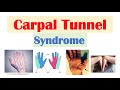 Carpal Tunnel Syndrome | Risk Factors, Pathogenesis, Signs & Symptoms, Diagnosis, Treatment