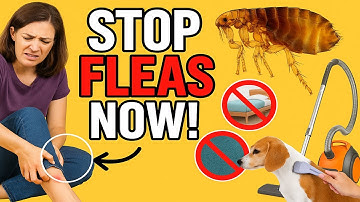 Ultimate Guide: How to Get Rid of Fleas on Humans Fast! – Home & Pet Solutions That Work!