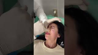 Is Your Nose Crooked? Correction Treatment, Without Surgery