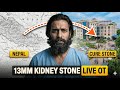 13MM Kidney Stone Removal LIVE OT | Nepal patient Kidney Stone Treatment #liveot #13mm