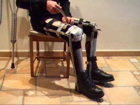 leg braces, bitutores, cafo, cafos, calliper, muletas, crutches, polio, dis...