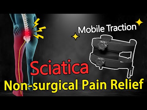 B18One Minute Medicine   Sciatica Pain Relief By Mobile Traction Device  Non surgery