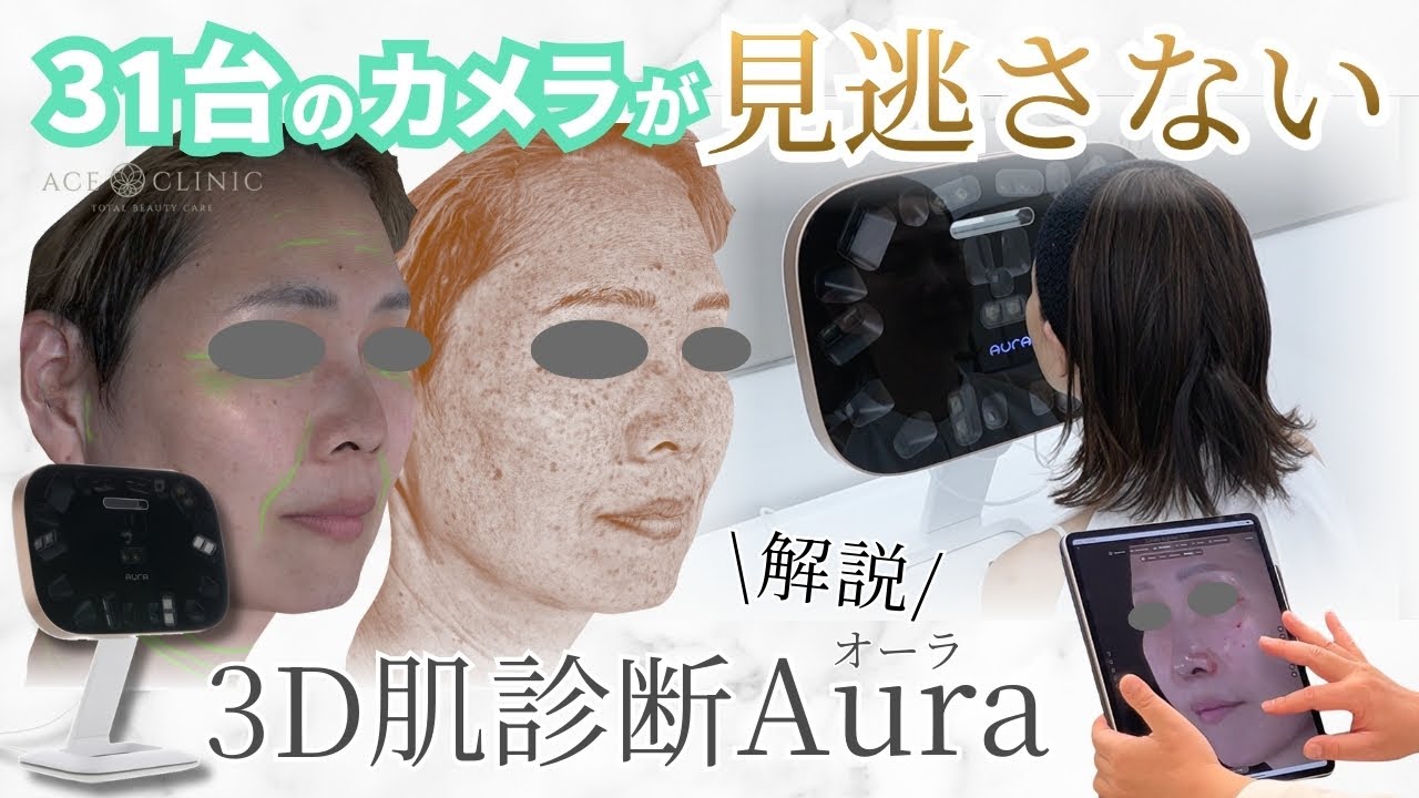 最新3D肌診断、Aura(オーラ)を解説！ - YouTube