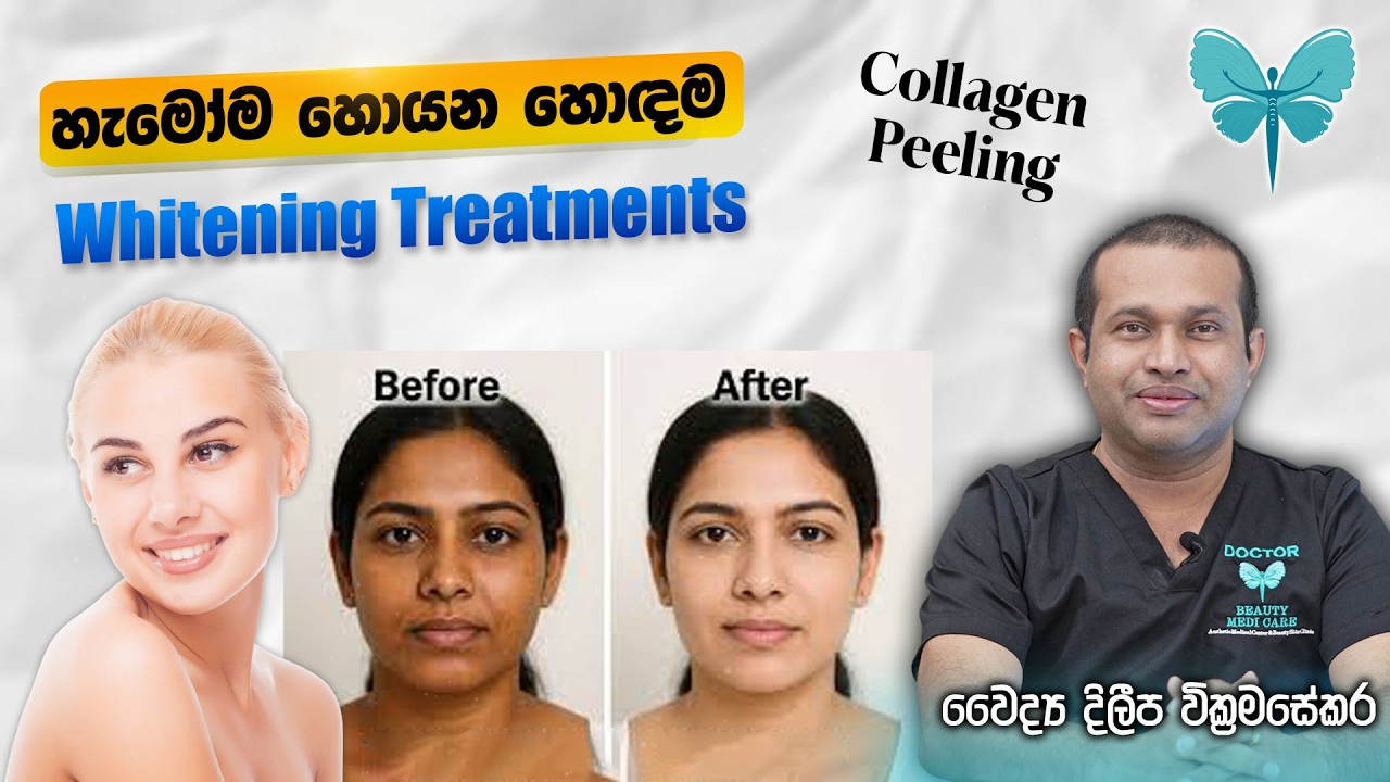 how to buy glutathione injection in sri lanka Benefits for Skin Whitening Glutathione Injection Strong Whitening Body