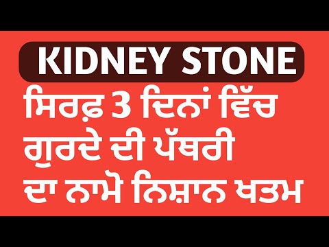 #NewVideo #KindeyStone ਗੁਰਦੇ ਦੀ ਪੱਥਰੀ ਦਾ ਘਰੇਲੂ ਇਲਾਜ,