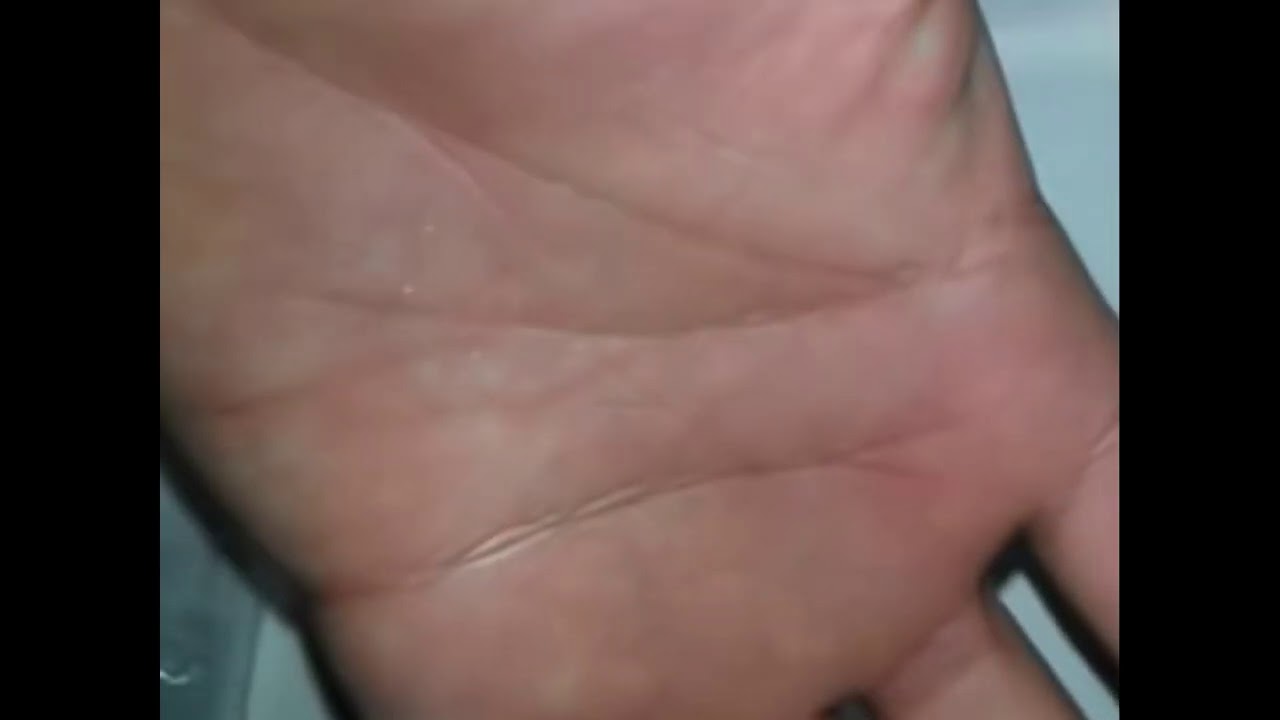 Most satisfying removal ever! YouTube