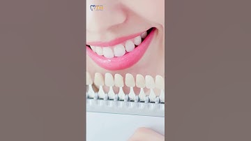Những Yếu Tố Ảnh Hưởng Đến Độ Bền Của Răng Sứ Bạn Cần Biết #BocRangSu #NhaKhoaTH  #KienThucNhaKhoa