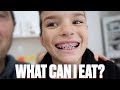 WHAT HURTS THE MOST GETTING BRACES FOR THE FIRST TIME | WHAT YOU CAN AND CAN'T EAT WITH NEW BRACES