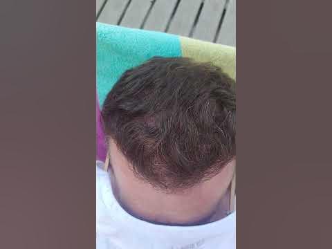 youtu.be
