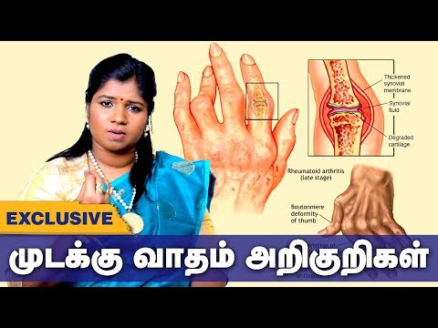 முடக்கு வாதம் அறிகுறிகள்!!! தீர்வு என்ன? | மூட்டுவலி சித்த சிகிச்சை | தமிழ் ஆரோக்கிய குறிப்புகள்