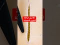 خياطة الجروح التجميلية 