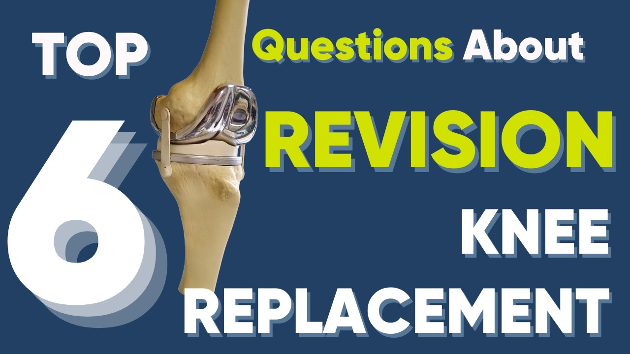 Top 6 tips about Revision Knee Replacement surgery! - YouTube