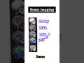🧠 "5 Powerful Brain Scans Explained in Seconds!", @studytips-p9n