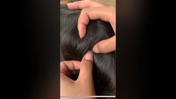 (Part 12) Lice Removal & Treatment: Advanced Lice - Picking Secrets