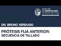 Prótesis Fija Anterior: Secuencia de Tallado — Dr. Bruno Verdugo