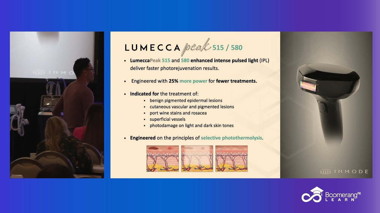 Lumecca by Dr. Maningas: The Ultimate IPL Solution for Radiant Skin ✨
