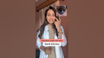 Dark circles | product recommendations