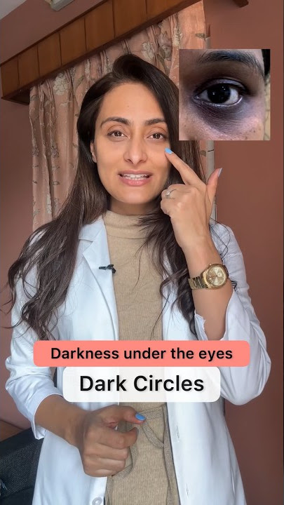 Dark circles | product recommendations